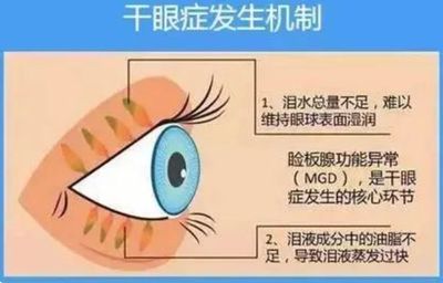 人一般多久眨一次眼睛