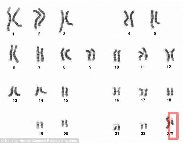 性染色体缺失孩子可以要吗