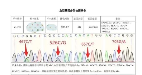 如果怎么测自己是ABO