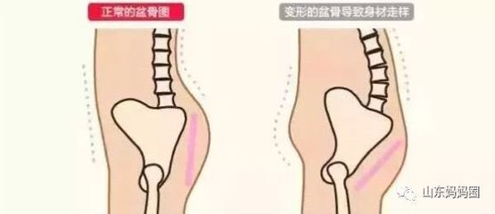 男人问顺产和剖腹产的意义