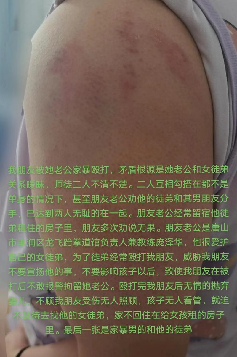 家暴男人真的改不了吗 老公动手打我怎么治他