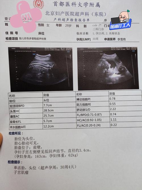 30周产检有哪些项目 30周小排畸和普通彩超一样么