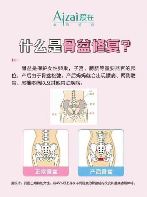 产后多久骨盆可以恢复正常 产后多久做骨盆修复效果最好