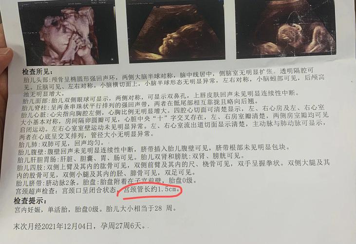 孕28周产检查什么项目 孕28周胎儿发育标准值是多少