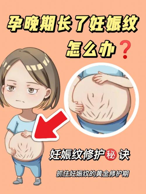 孕妇用橄榄油可以防止妊娠纹吗 几个月长妊娠纹和妊娠线