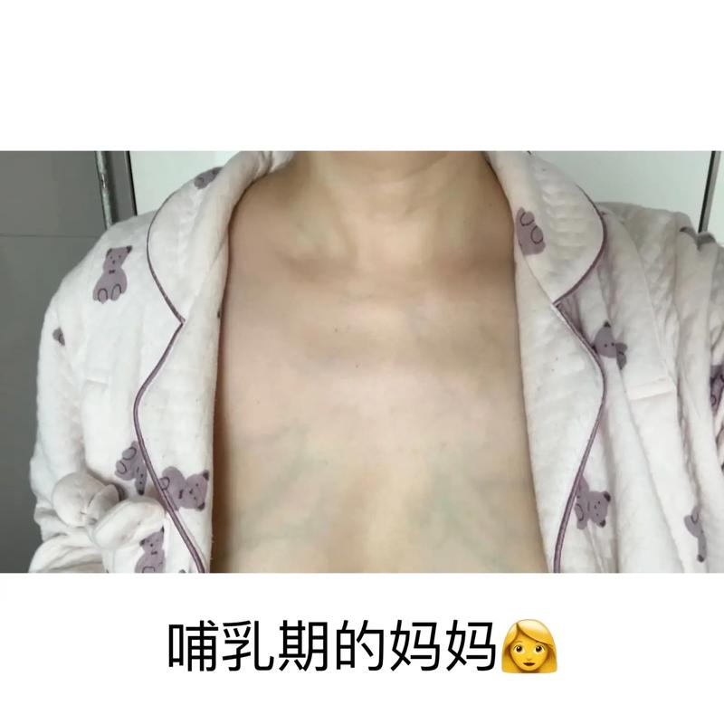 发炎的乳腺可以喂奶吗 哺乳期乳腺炎会自愈吗